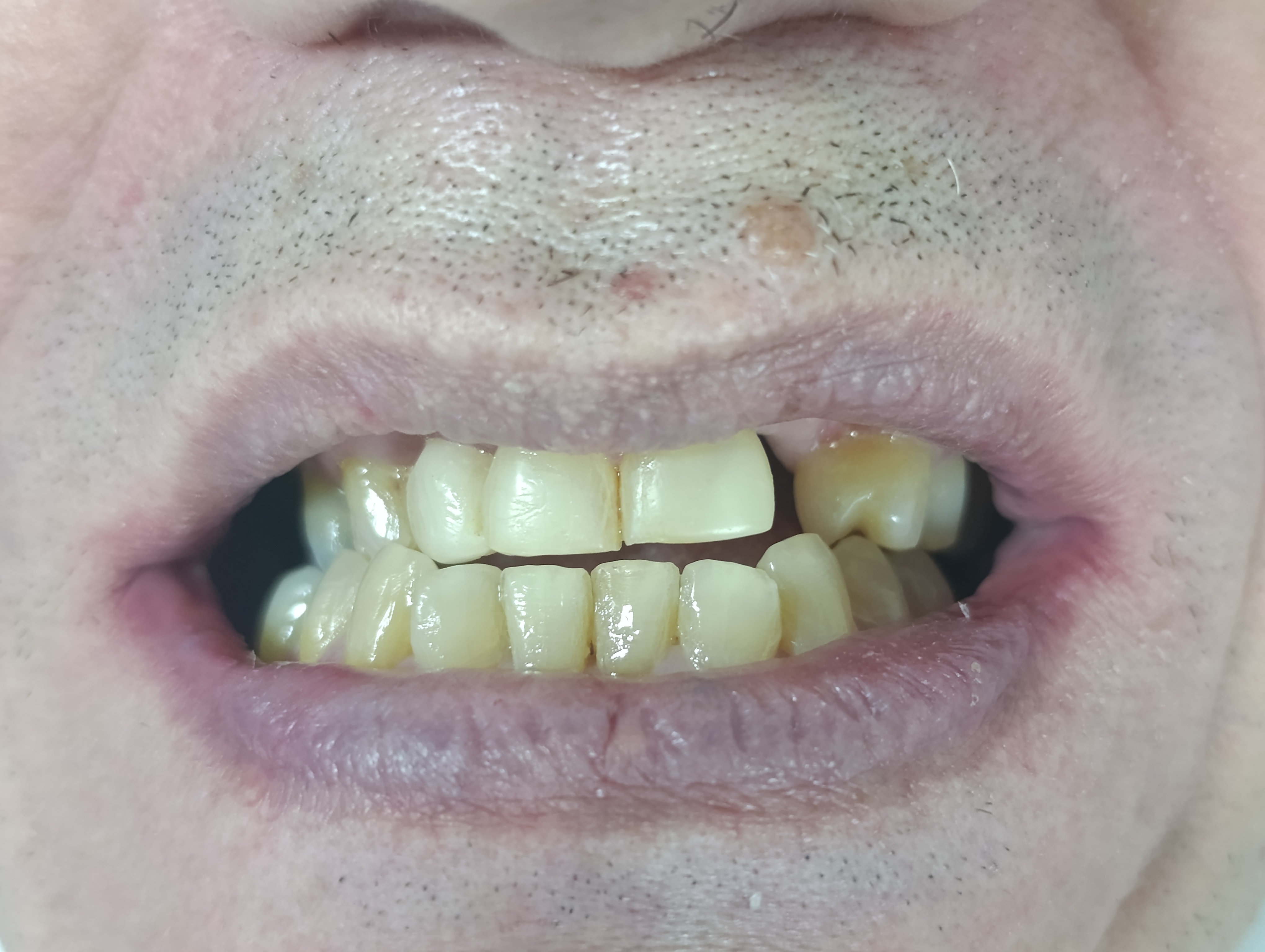 Paciente 2 - Estado Inicial